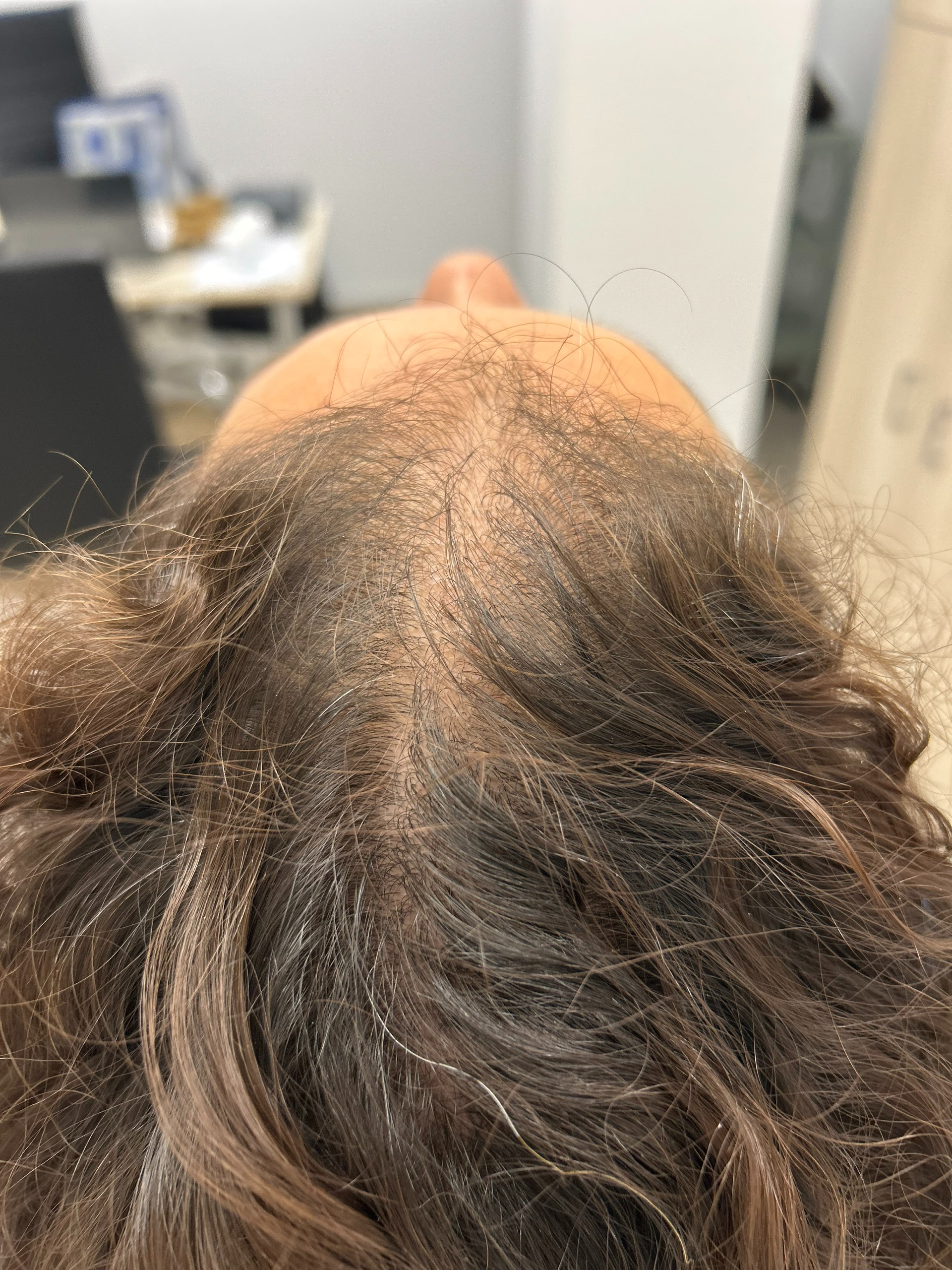 Antes del tratamiento · Caso 4